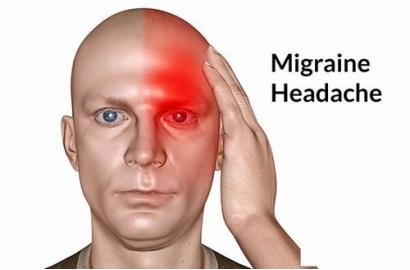 Những điều cần biết về bệnh đau nửa đầu